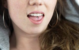 How to Treat Infected Tongue Piercing