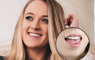 How to Hide a Tongue Piercing